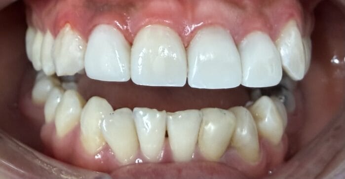 After